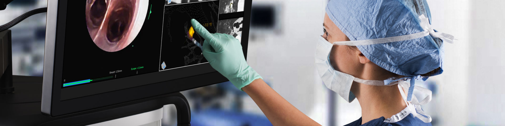 Lung Cancer Treatment at USA Health