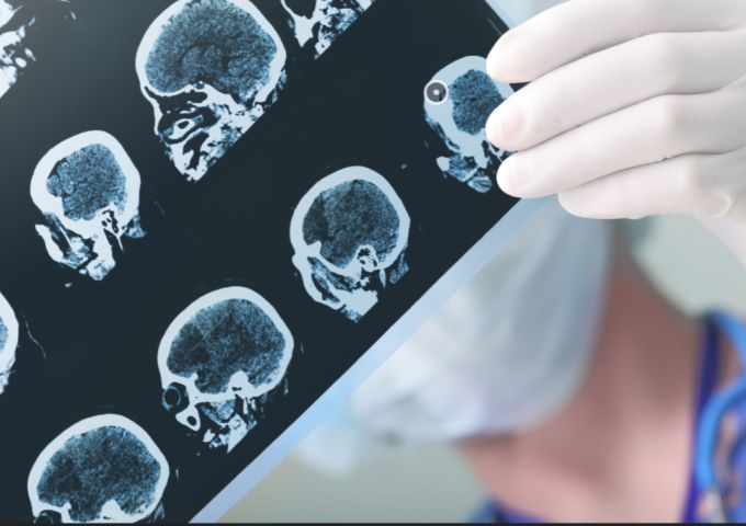 NEURO pic
